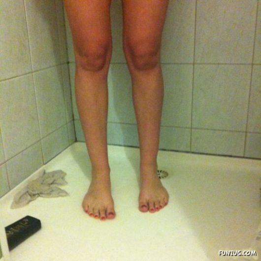Knees That Look Like Faces