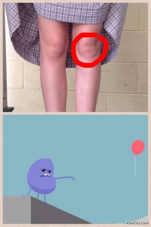 Knees That Look Like Faces