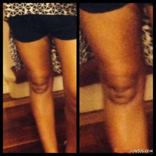 Knees That Look Like Faces