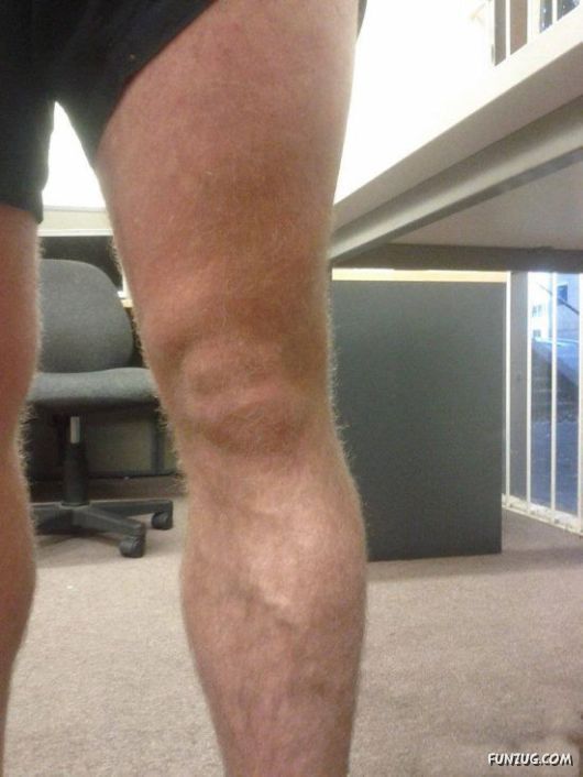 Knees That Look Like Faces